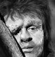 O ator galês Anthony Hopkins interpretou Quasimodo em um filme de 1982  Foto: Getty Images / BBC News Brasil
