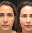 A ex-paquita Andrea Sorvetão, que realizou procedimento de harmonização facial.  Foto: Instagram/@andreasorvetaooficial / Estadão