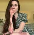 Americana Lucy Beal Lott tem 20 anos e nasceu com uma doença genética e hereditária rara chamada epidermólise bolhosa (EB)  Foto: Lucy Beal Lott / BBC News Brasil