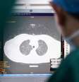 "Em alguns pacientes, a função pulmonar pode cair de 20% a 30% após a cura", afirma médico de Hong Kong  Foto: DW / Deutsche Welle