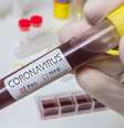 Kits permitirão que o resultado dos testes de coronavírus fique pronto em 15 minutos  Foto: Seleções