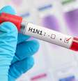 A pandemia de H1N1 afetou mais de 200 países entre 2009 e 2010  Foto: Getty Images / BBC News Brasil