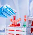 Para especialistas, é muito provável primeiro caso do novo coronavírus aconteceu antes de 25 de fevereiro, data da primeira confirmação no país, mas não foi diagnosticado  Foto: Getty Images / BBC News Brasil