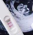 Vários Estados afirmam que abortos são procedimentos não essenciais, e ativistas dizem que restrições violam direito constitucional  Foto: Getty Images / BBC News Brasil