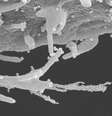 As imagens reveladas pelo estudo mostram células humanas infectadas com um detalhamento inédito  Foto: ELIZABETH FISCHER, MICROSCOPY UNIT NIH/NIAID / BBC News Brasil