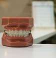 Aparelho dental na infância evita harmonização facial no futuro  Foto: Unplash