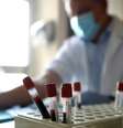 Testes com anticorpos mostraram bons resultados contra a Covid-19  Foto: ANSA / Ansa