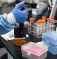 Casos de reinfecção chamam atenção
06/10/2020
REUTERS/Khushnum Bhandari  Foto: Reuters