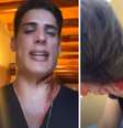 Tiago Ramos apareceu cheio de sangue em vídeos no Instagram  Foto: Reprodução/Instagram 