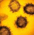 A Covid-19 deixa algumas pessoas gravemente doentes, enquanto outras não apresentam nenhum sintoma  Foto: Science Photo Library / BBC News Brasil