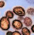 No último sábado, o Reino Unido anunciou a descoberta de uma nova variante do coronavírus mais infecciosa e "fora de controle", segundo o ministro da Saúde britânico Matt Hancock  Foto: EPA / BBC News Brasil