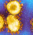 País tem infraestrutura e cientistas experientes, mas falta verba para fazer uma ampla vigilância genômica do Sars-CoV-2  Foto: SCIENCE PHOTO LIBRARY / BBC News Brasil