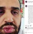 Infectologista José Eduardo Panini disse ter sido agredido depois de tentar alertar pessoas sobre os riscos de contágio do coronavírus.  Foto: Reprodução/ Instagram / Estadão