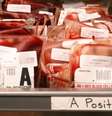 Artigo na revista científica Blood Advances, publicada mês passado, afirmou que coronavírus tem 'forte preferência' em se ligar a proteínas que só o tipo sanguíneo A tem  Foto: Getty Images/John Foxx / BBC News Brasil