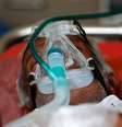 Paciente com máscara de oxigênio em ambulância em Ahmedabad, na Índia
25/04/2021 REUTERS/Amit Dave  Foto: Reuters