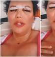 Luisa Marilac na primeira aparição na internet após a cirurgia: complicações do silicone industrial colocaram sua vida em risco  Foto: Reproduções