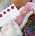 A pesquisa utilizou a mesma gota de sangue no papel filtro coletada para a triagem neonatal, chamada de teste do pezinho. Os bebês não passam por nenhum procedimento diferente do habitual.  Foto: Divulgação/Nupad/Faculdade de Medicina da UFMG / Estadão