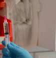 O aducanumabe tem como alvo uma proteína chamada amiloide, que forma aglomerados anormais no cérebro de pessoas com Alzheimer  Foto: BBC News Brasil