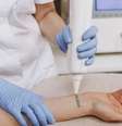 Como lidar com o arrependimento da tatuagem?  Foto: Shutterstock / Alto Astral