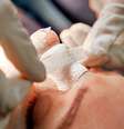 Rinoplastias devem ser feitas em hospitais ou clínicas estéticas autorizadas, sempre acompanhadas por médicos especialistas no assunto  Foto: Getty Images / BBC News Brasil