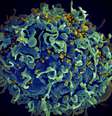 Vírus do HIV (em amarelo) infectando uma célula humana  Foto: National Cancer Institute