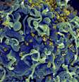 Eletromicrografia mostra HIV infectando célula humana; variante VB levou a maior carga viral em pacientes ainda sem tratamento  Foto: Getty Images / BBC News Brasil
