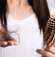 A queda de cabelo pode levar de dois a três meses após o contágio para aparecer  Foto: Shutterstock / Alto Astral