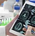 Estudos científicos mostraram alterações no cérebro em exames de imagem de pacientes que tiveram covid  Foto: Getty Images / BBC News Brasil