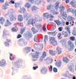 Tratamento prevê que células são coletadas para serem alteradas com um novo gene  Foto: Instituto Nacional do Câncer / Divulgação / Estadão