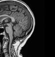 exame de ressonância magnética  Foto: UK Biobank / BBC News Brasil