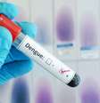 Vacina da dengue foi desenvolvida pela farmacêutica Takeda  Foto: Shutterstock / Saúde em Dia
