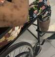 Mulher tem perna necrosada após demora em atendimento  Foto: Reprodução/Redes Sociais