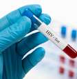 Diagnóstico de HIV retrocede na população LGBTQIA+ no Reino Unido, mas Brasil vive passo atrás  Foto: Piotr Malczyk / Alamy / via Reuters