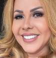 Inchaço de Joelma está associado a Covid-19; especialistas comentam  Foto: Reprodução Instagram / Saúde em Dia