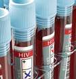 Entenda a nova variante do HIV  Foto: Shutterstock / Saúde em Dia