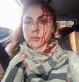 Vítima teve ferimentos no rosto após ser agredida por procurador em SP  Foto: Arquivo Pessoal
