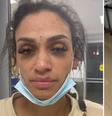 Mychelle Johnson, 24, acusou o  marido, Miles Bridges, jogador do Charlotte Hornets, de agressão  Foto: Reprodução/Instagram