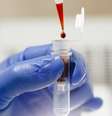 Exame de sangue  Foto: Future Publishing/Getty Images / BBC News Brasil