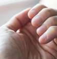 O aparecimento de sinais nas unhas demanda uma avaliação com um dermatologista para avaliar individualmente cada caso e realizar exames  Foto: Getty Images / BBC News Brasil