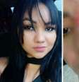 Esteticista teve necrose e perdeu parte do nariz após realizar uma alectomia  Foto: Reprodução TikTok / Saúde em Dia