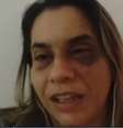 Empresária denunciou ex-companheiro por agressões  Foto: Reprodução/TV Bahia