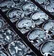 Pessoas de meia-idade que têm pesadelos toda semana podem ter mais risco de passar por declínio cognitivo (Imagem: alexstand/envato)  Foto: Canaltech