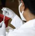 Estudo envolveu 12 pacientes e apresentou resultados promissores  Foto: EPA / Ansa - Brasil