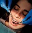 Dentes têm capacidade limitada de regeneração  Foto: Pexels