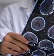 Esclerose múltipla: especialista esclarece mitos e verdades sobre a doença  Foto: Shutterstock / Saúde em Dia