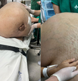 A paciente só procurou ajuda médica pois estava sentindo dificuldade de respirar  Foto: Reprodução/ Instagram: @drglaucioboechat