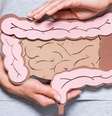 Câncer no intestino  Foto: Shutterstock / Saúde em Dia
