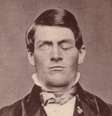 Phineas P. Gage (1823–1860), que teve cabeça atravessada por barra de ferro em 13 de setembro de 1848  Foto: Wikimedia Commons