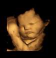  Foto: Psychological Science/Reprodução / Bebe.com