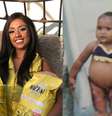 Letícia Ramos foi diagnosticada com glicogenose aos dois anos e meio; desde então, ela precisa consumir amido de milho de três em três horas como parte do tratamento  Foto: Arquivo Pessoal/Letícia Ramos
